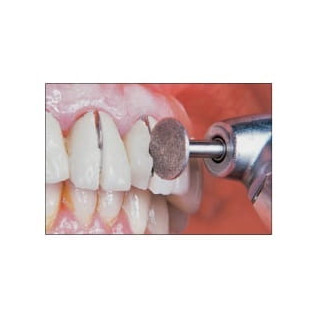 TARCZKA DIAMENTOWA DO PRZECINANIA KORON NA KĄTNICE