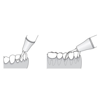 T3 EMS / WOODPECKER / MECTRON PERIO b®